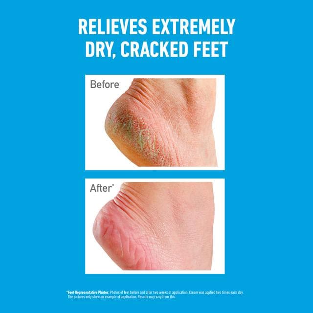 O'Keeffe's for Healthy Feet Foot Cream 91g - gallery image 3