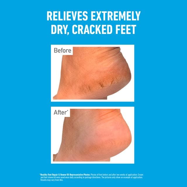 O'Keeffe's for Healthy Feet Exfoliating Moisturising Foot Cream 85ml - gallery image 3