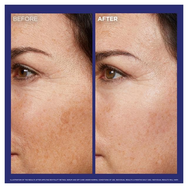 L'Oreal Paris Revitalift Laser Pure Retinol Deep Anti-Wrinkle Night Serum 30ml - gallery image 3