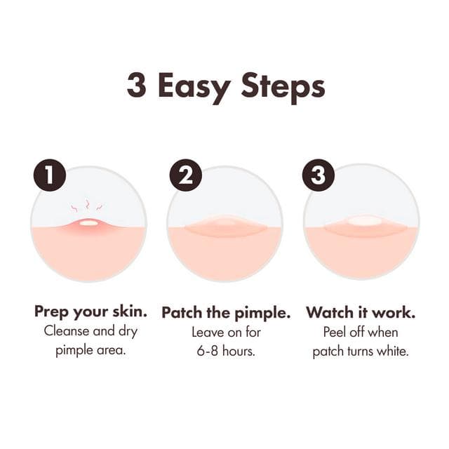 Mighty Patch Duo Pimple Patches From Hero Cosmetics Pimple Patches x12 - gallery image 5