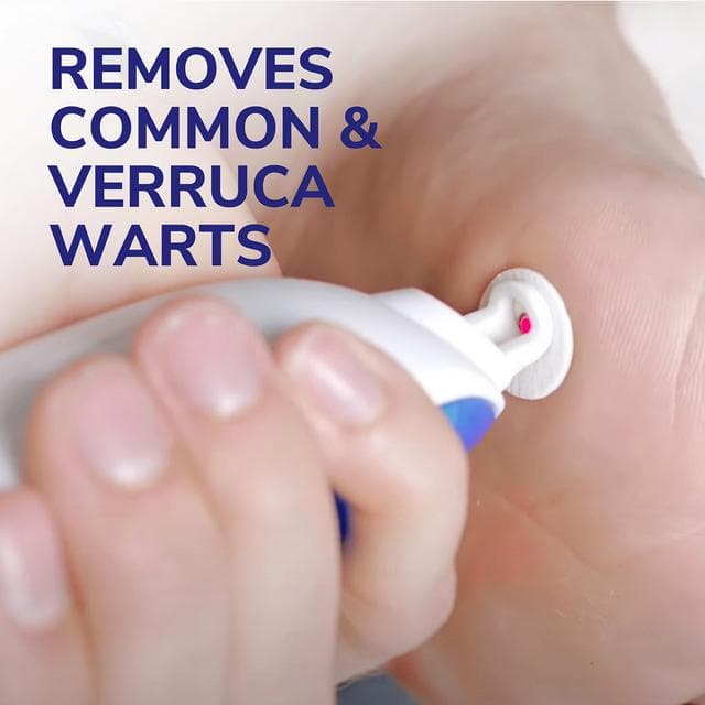 Dr. Scholl's Freeze Away Max Verruca & Wart Remover 35ml - gallery image 2