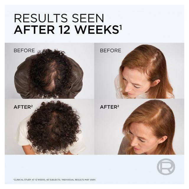 L'Oreal Paris Elvive Growth Booster Shampoo Anti Hair Loss for Men & Women 200ml - gallery image 5