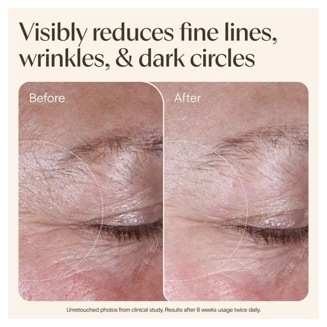 Aveeno 15ml Face Age Renewal Retinol Alternative Eye Gel Cream - gallery image 5