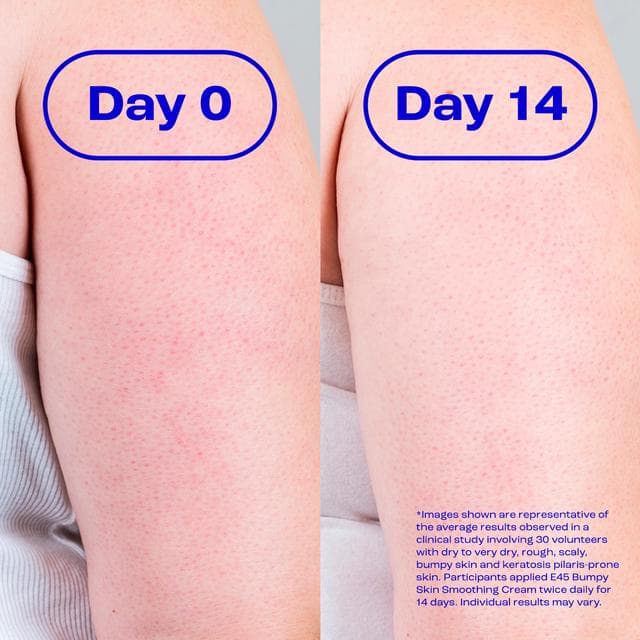 E45 100g Bumpy Skin Smoothing Cream - gallery image 3