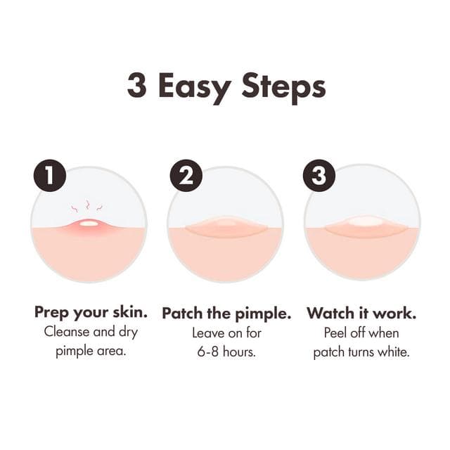 Hero 10 Mighty Surface Spot Pimple Patches - gallery image 6