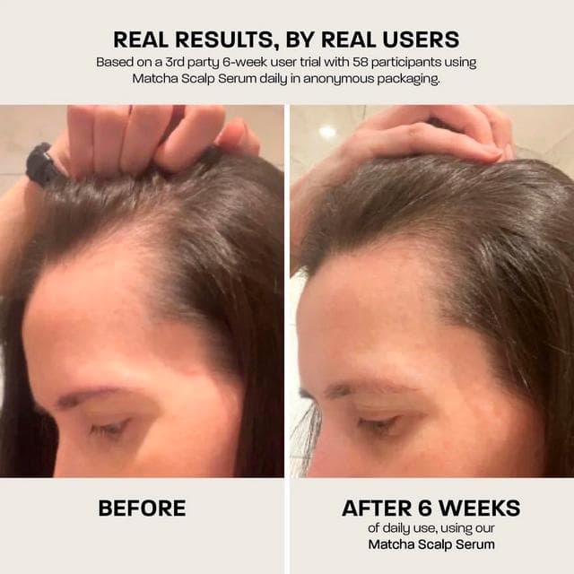 Rehab 90ml Matcha Scalp Serum - gallery image 6