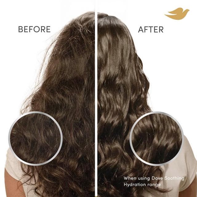Dove 45ml Scalp + Hair Therapy Soothing Hydration 3 in 1 Scalp Serum - gallery image 5