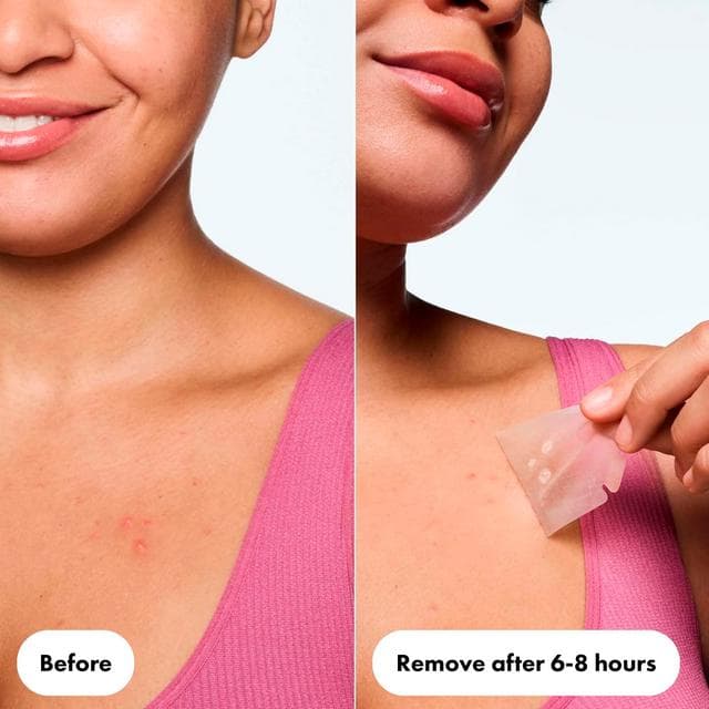 Hero Mighty Patch 4 x Body Hydrocolloid Patches - gallery image 3
