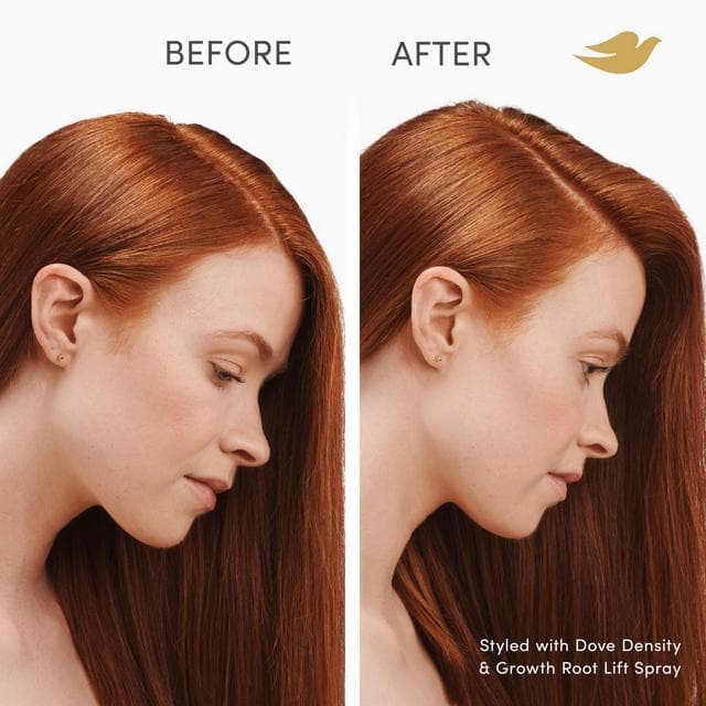 Dove 100ml Density & Growth Root Lift Scalp Therapy Hair Spray - gallery image 6